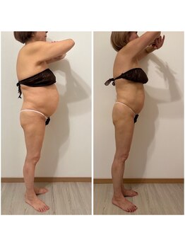 マシェリ(Ma che'rie)/ポッコリお腹撃退！