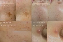 リュノン(Lunon.)