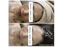 ビューティ スペース ルーチ(beauty space Luci)/クリスティーナbefore→after