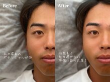 トレミニョン(tres mignon)/