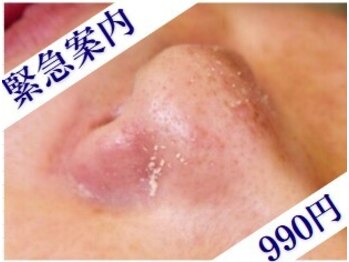 グルステ 六本木店