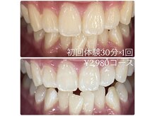 ホワイトニングルーム 横浜店(Whitening Room)/セルフホワイトニング/横浜