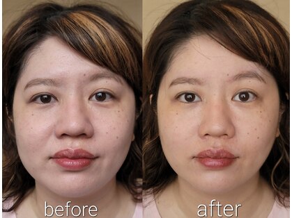 楓整骨院の写真