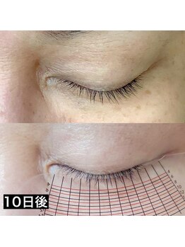 スプーンプラス アイラッシュ(spoon+eyelash)/ラッシュアディクト