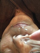 グリーンノート(GREEN NOTE)/鼻の毛穴の汚れ