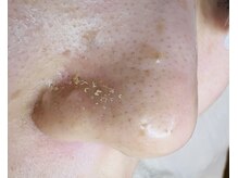 クワ(Cuwa)の雰囲気（Cuwaの「エクストラクション」はお肌への負担が最小限☆）