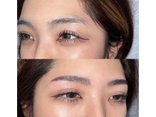 グレーシェル 天神大名店(Gracher)/HBL Before→After