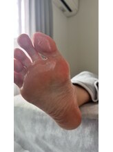 フットミー(foot mii)/うるつや足裏★新感覚