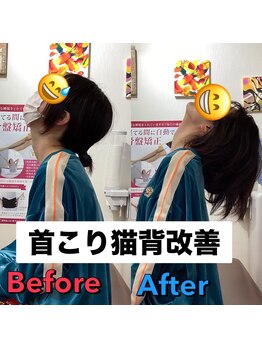 ヒデ整体院(Hide整体院)/猫背矯正骨盤矯正B/A肩こり腰痛