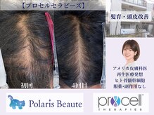 ポラリスボーテ 東京池袋