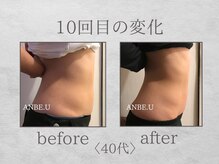 アンビーユー(ANBE.U)/腸もみビフォーアフター