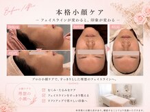 ベアール(beal)の雰囲気（大人気の本格小顔ケア♪むくみ/左右差/凝り解消！クーポンcheck）