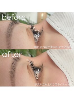 ビューティーグロウ(BEAUTY-GROW)/