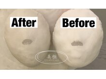 美極 トータルビューティー(美極 TOTAL BEAUTY)/恵比寿/小顔コルギ/エステ/