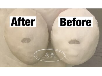 美極 トータルビューティー(美極 TOTAL BEAUTY)/恵比寿/小顔コルギ/エステ/