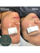 チョンダムビューティー(chondam beauty)/ムルグァン(水光)肌はお任せ～