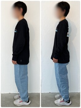 キトウミ(kitoumi)/before after