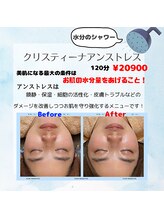 チャンプ 高の原店(Champ)/【最強！】水分爆弾エステ