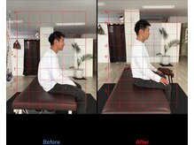 ストレチックス 近江八幡店/ストレッチ　ビフォーアフター