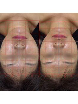 ハーモニーフィットネス 赤坂(Harmony Fitness)/リフトアップ