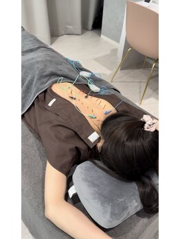ミトノウ(MITONOU)の写真/眠れない夜、目の疲れ、頭の重み…その“ひと刺し”が軽やかな明日へ導きます!眼精疲労のお方におすすめ◎