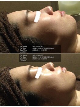 ブリエールラミール/たるみケア、美肌