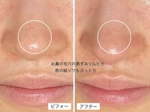 スローガーデン(Slow Garden)/ハーブ　ビフォーアフター