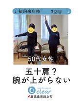 クリア(clear)/腕が上がらなかった50代女性