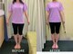 整音(totonone)の写真/その場しのぎではなく定着へ。最短1ヶ月で理想の美脚に。