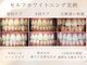 ホワイトニングバー 心斎橋オーパ店の写真