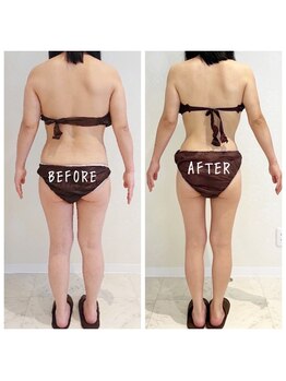 デジール(DESIR)/全身燃焼コース10回