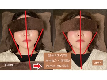 整体サロン宇宙/☆本格あご・小顔矯正☆