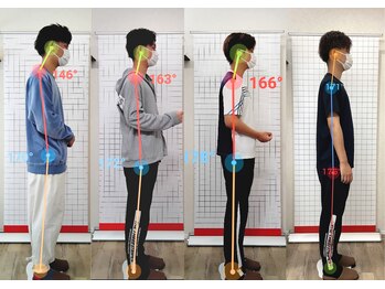 神谷澤鍼灸整骨院/猫背矯正/骨盤矯正