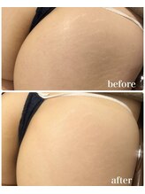 バニーヒップ(Bunny Hip)/