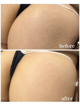 バニーヒップ(Bunny Hip)/