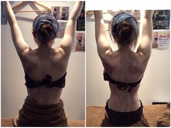 クレビア 神保町 水道橋(CREBIA)/スライドカッピング/痩身サロン