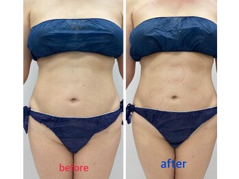 凪 横浜/音波の波動と40.68の温熱