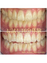 ライトビューティー 本八幡店(LIGHT BEAUTY)/お客様ビフォーアフター♪ 