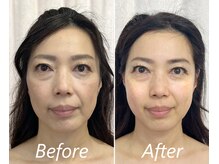 ドクターボディ 新宿店(Dr.Body)/【面長/たるみ/むくみ改善50代】