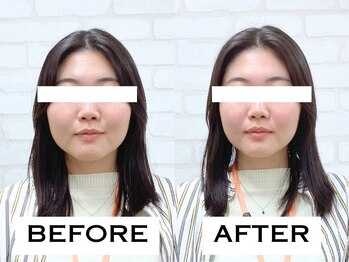 ビハリスト 秋葉原電気街口店/むくみがとれて輪郭がすっきり！