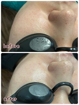 ケースタイル(k.style)/ブラックカーボンフォト