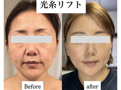 エミナル(EMINARU)の写真