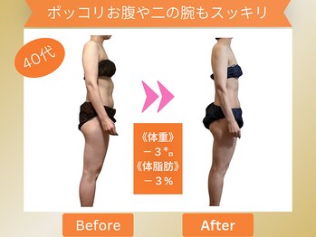 ヨサパーク ナンシー(YOSA PARK Nancy)/ポッコリお腹・二の腕もスッキリ