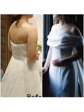 トータルボディケア サニー(TOTAL BODY CARE)/ブライダルエステbefore after