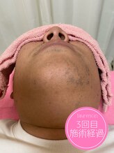 ローランサン(laurencin)/【After3】