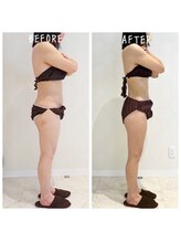 デジール(DESIR)/全身燃焼コース10回