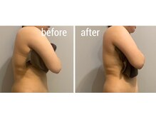 サロンシファ(salon sifa)/上半身インディバ