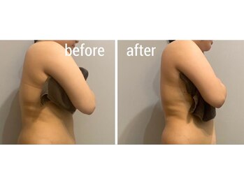 サロンシファ(salon sifa)/上半身インディバ