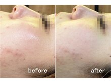 ハクミー(haku me)/☆次世代リバイブハーブ☆