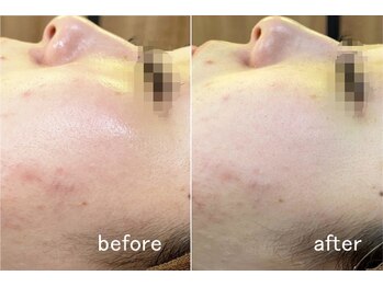 ハクミー(haku me)/☆次世代リバイブハーブ☆